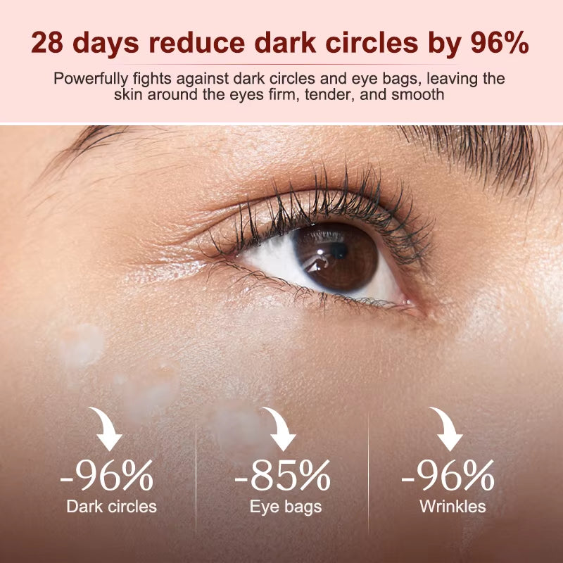 Astaxanthin Dark Circles Remover Eye Bags Eye Cream anti Wrinkle Firmness Moisturizing Eyes Serum Skin Care Beauty Products